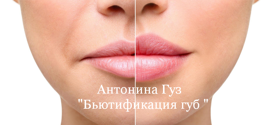 [Антонина Гуз] Бьютификация губ (2023)_0.png